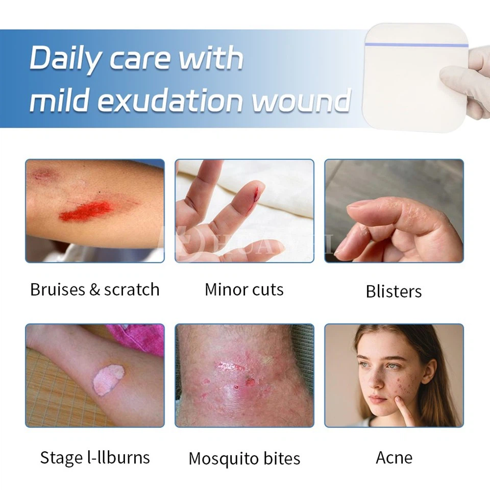 Ultra Thin Waterproof Hydrocolloid Wound Dressing best